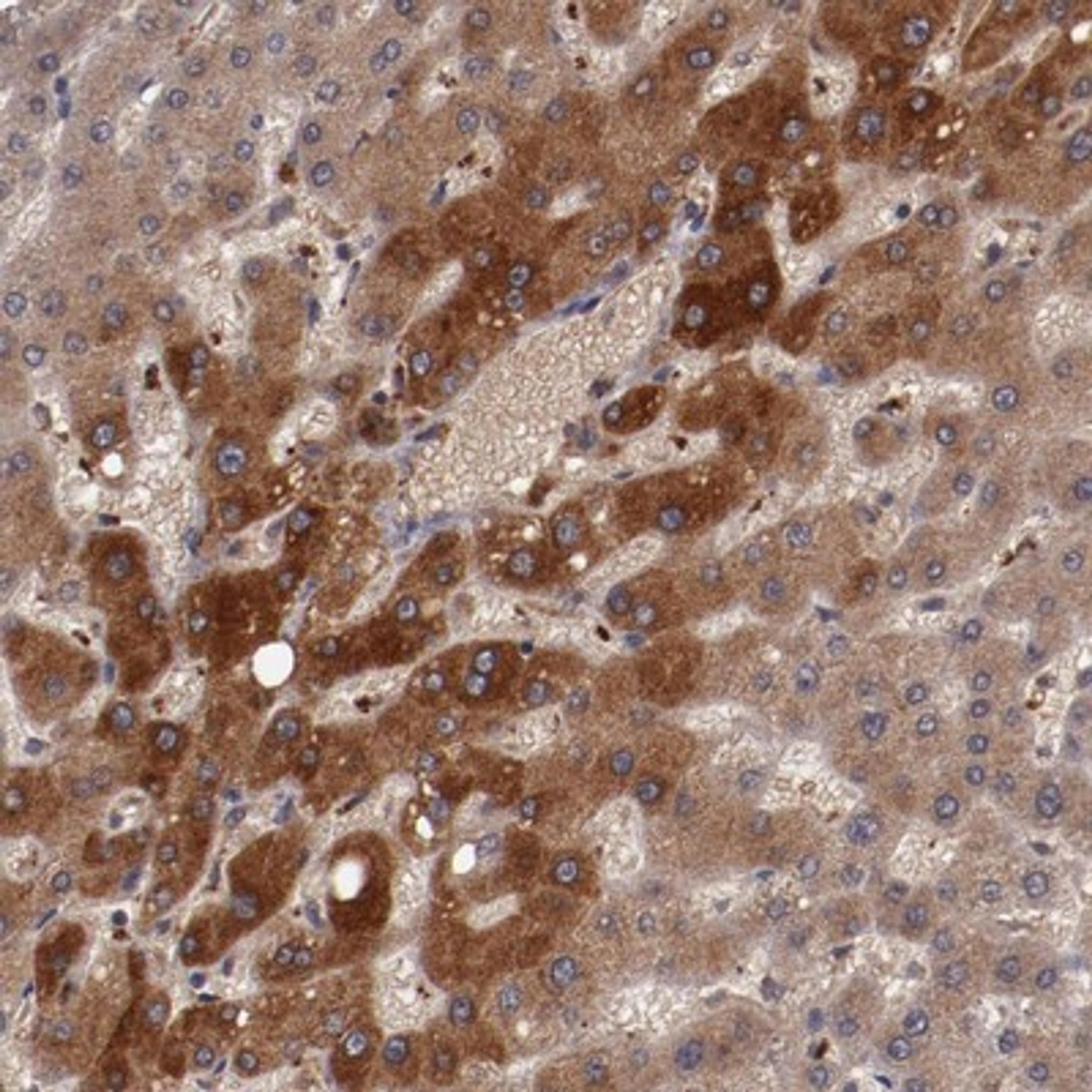 Immunohistochemistry-Paraffin: Ceruloplasmin Antibody [NBP1-88116] - Staining of human liver shows moderate cytoplasmic positivity in hepatocytes.