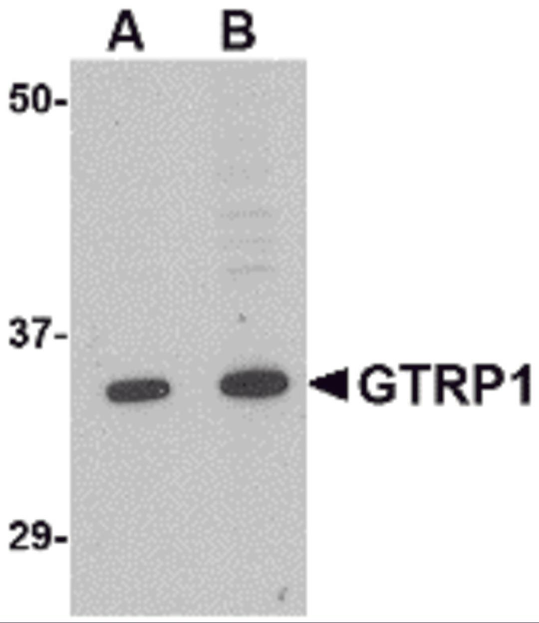 Western blot analysis of GRTP1 in K562 cell lysate with GRTP1 antibody at (A) 1 and (B) 2 μg/mL.