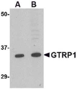 Western blot analysis of GRTP1 in K562 cell lysate with GRTP1 antibody at (A) 1 and (B) 2 μg/mL.