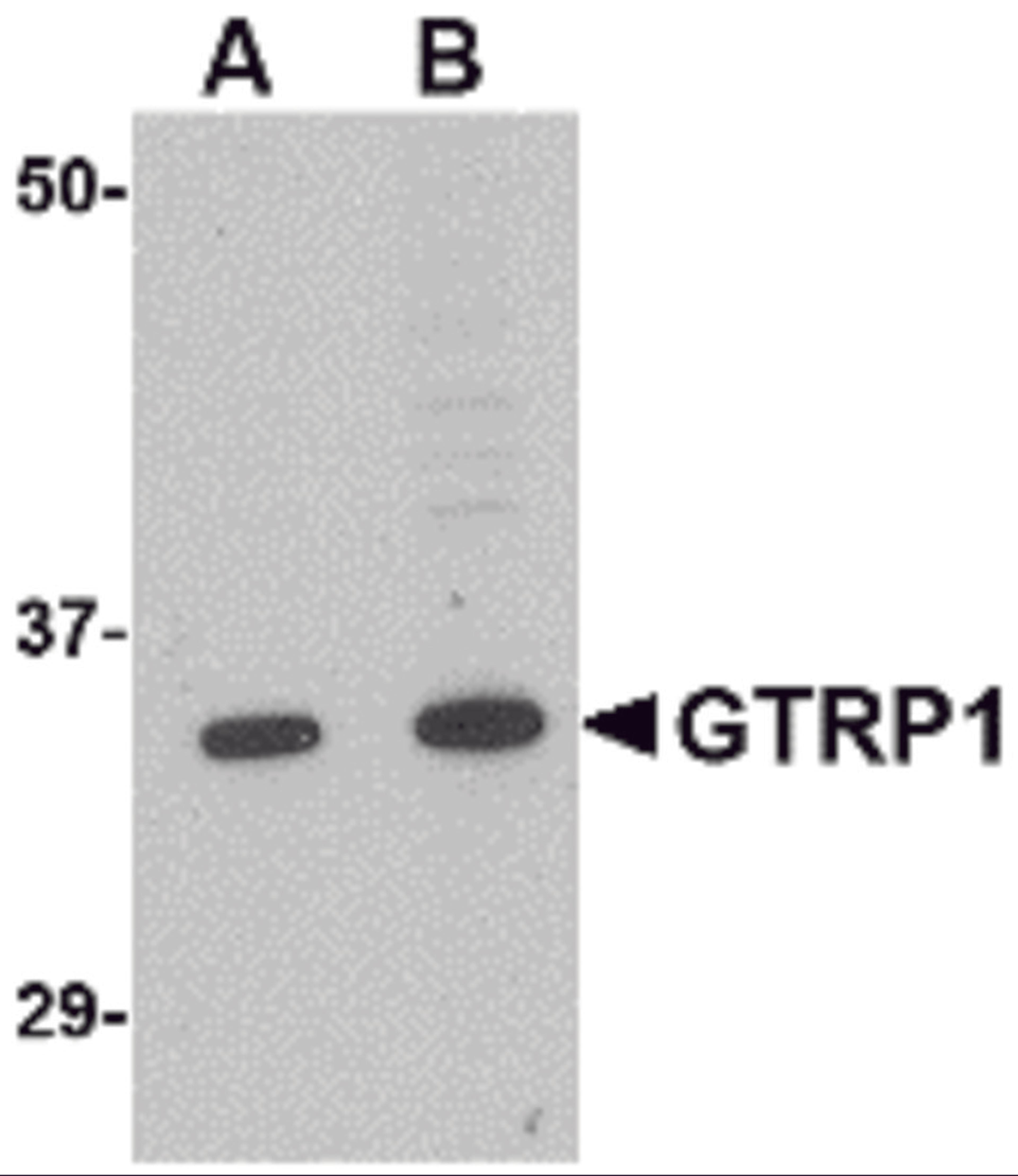 Western blot analysis of GRTP1 in K562 cell lysate with GRTP1 antibody at (A) 1 and (B) 2 μg/mL.