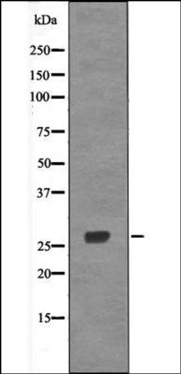 Western blot analysis of HeLa whole cell lysates using p27 Kip1 -Phospho-Thr157- antibody