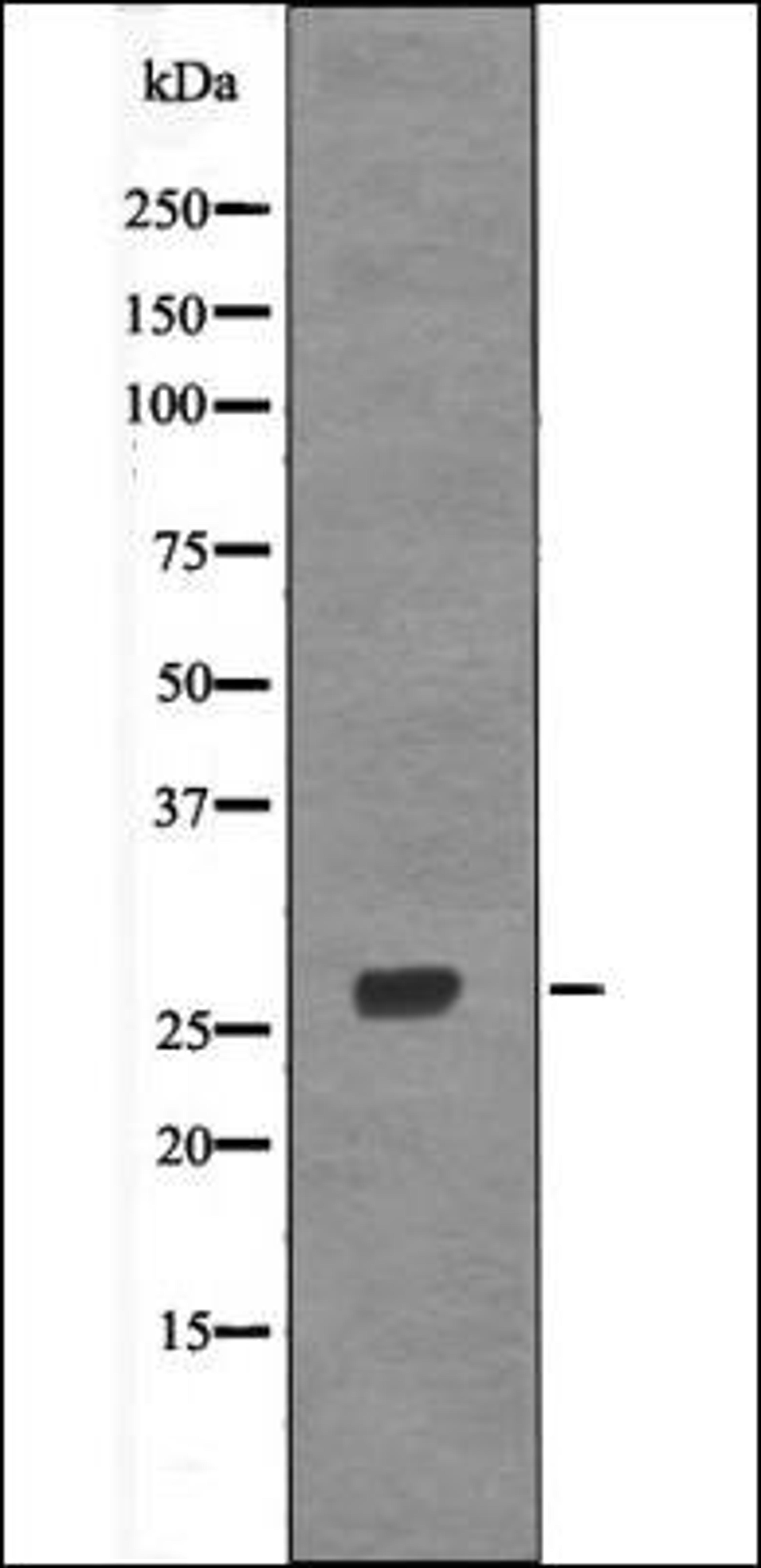 Western blot analysis of HeLa whole cell lysates using p27 Kip1 -Phospho-Thr157- antibody