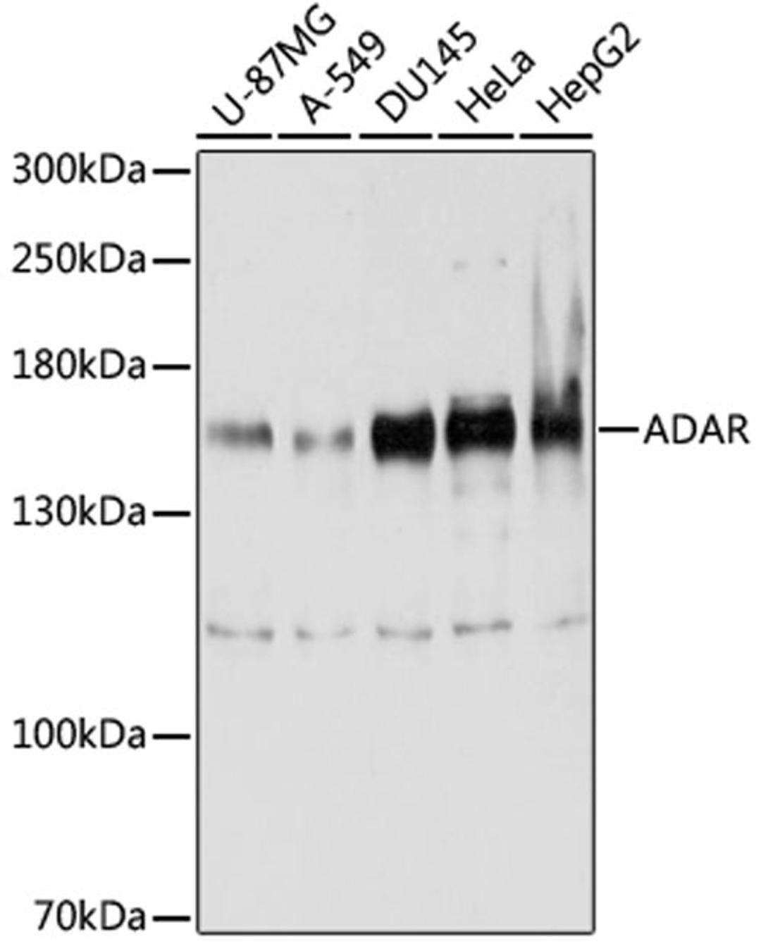 Western blot - ADAR antibody (A7869)