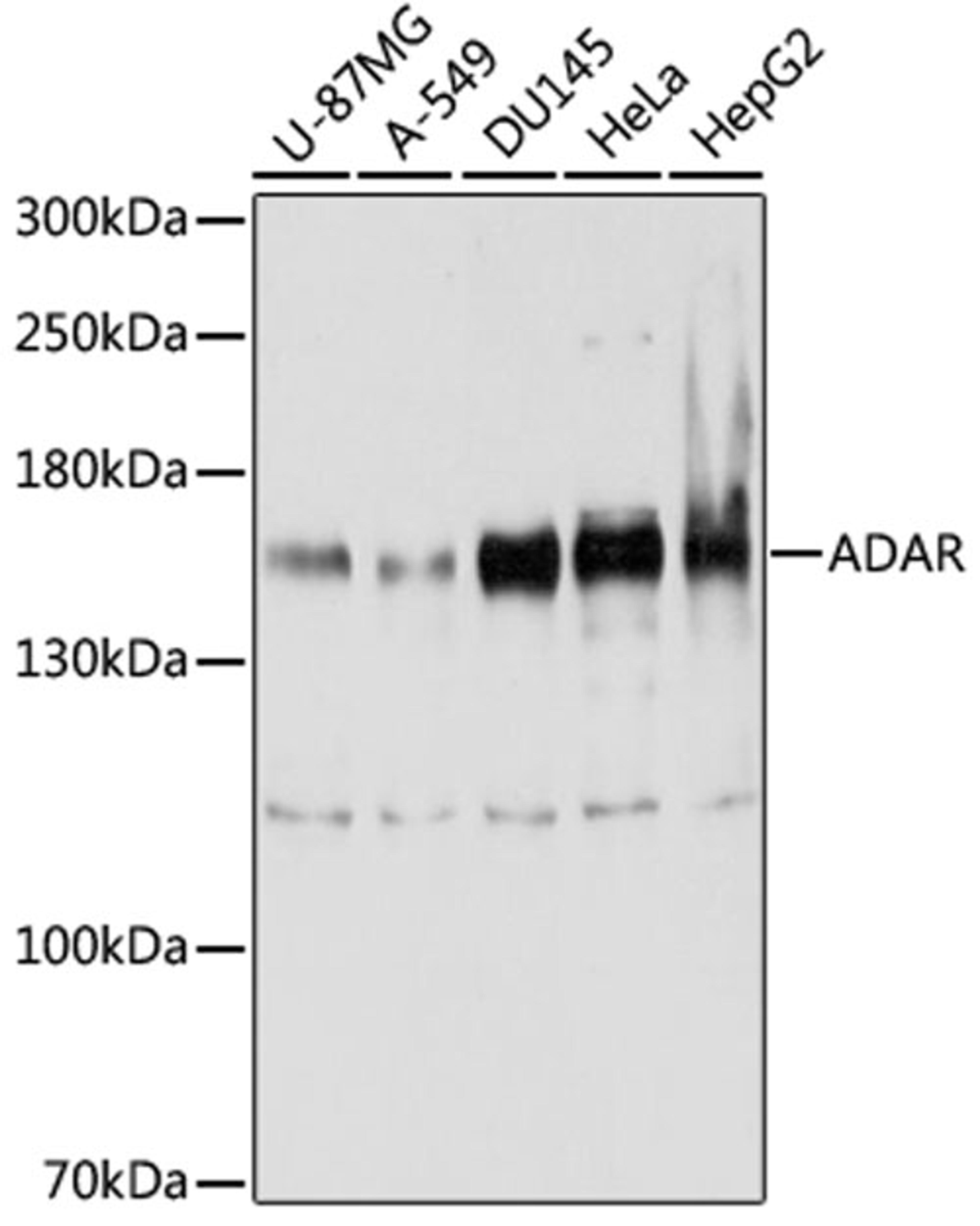 Western blot - ADAR antibody (A7869)