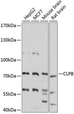 Western blot - CLPB antibody (A9130)