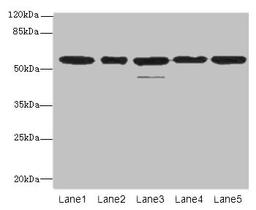 Western blot. All lanes: RBBP4 antibody at 1µg/ml. Lane 1: Hela whole cell lysate. Lane 2: LO2 whole cell lysate. Lane 3: K562 whole cell lysate. Lane 4: NIH/3T3 whole cell lysate. Lane 5: Raji whole cell lysate. Secondary. Goat polyclonal to rabbit IgG at 1/10000 dilution. Predicted band size: 48, 47, 44 kDa. Observed band size: 48, 55 kDa