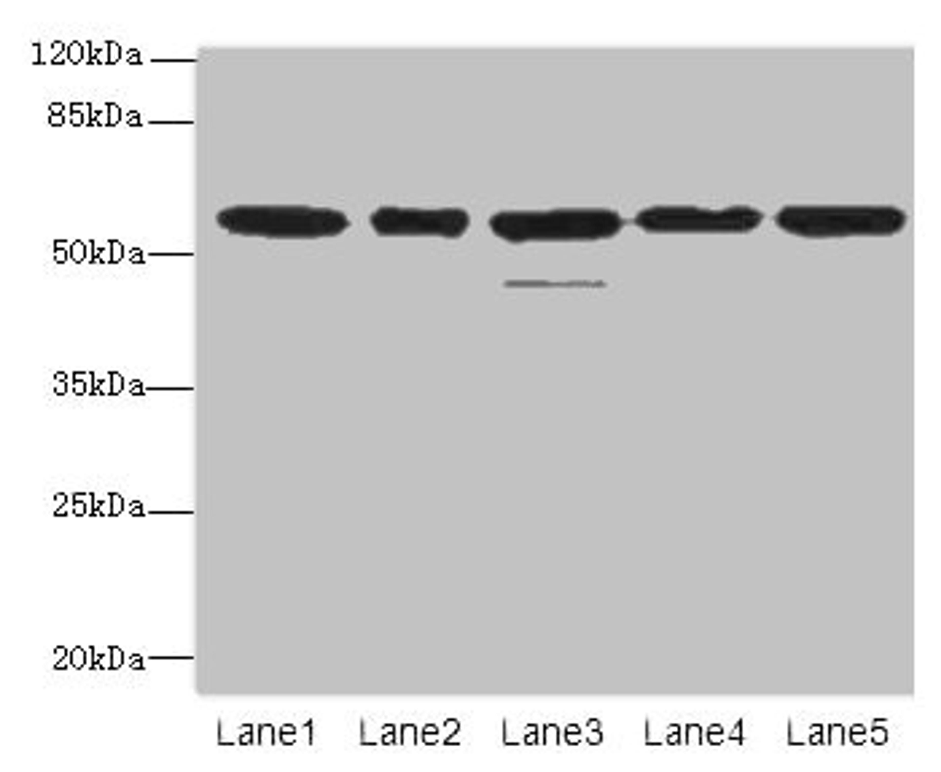 Western blot. All lanes: RBBP4 antibody at 1µg/ml. Lane 1: Hela whole cell lysate. Lane 2: LO2 whole cell lysate. Lane 3: K562 whole cell lysate. Lane 4: NIH/3T3 whole cell lysate. Lane 5: Raji whole cell lysate. Secondary. Goat polyclonal to rabbit IgG at 1/10000 dilution. Predicted band size: 48, 47, 44 kDa. Observed band size: 48, 55 kDa