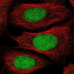 Immunocytochemistry/Immunofluorescence: DPPA2 Antibody [NBP1-85426] Staining of human cell line U-2 OS shows positivity in nucleus.