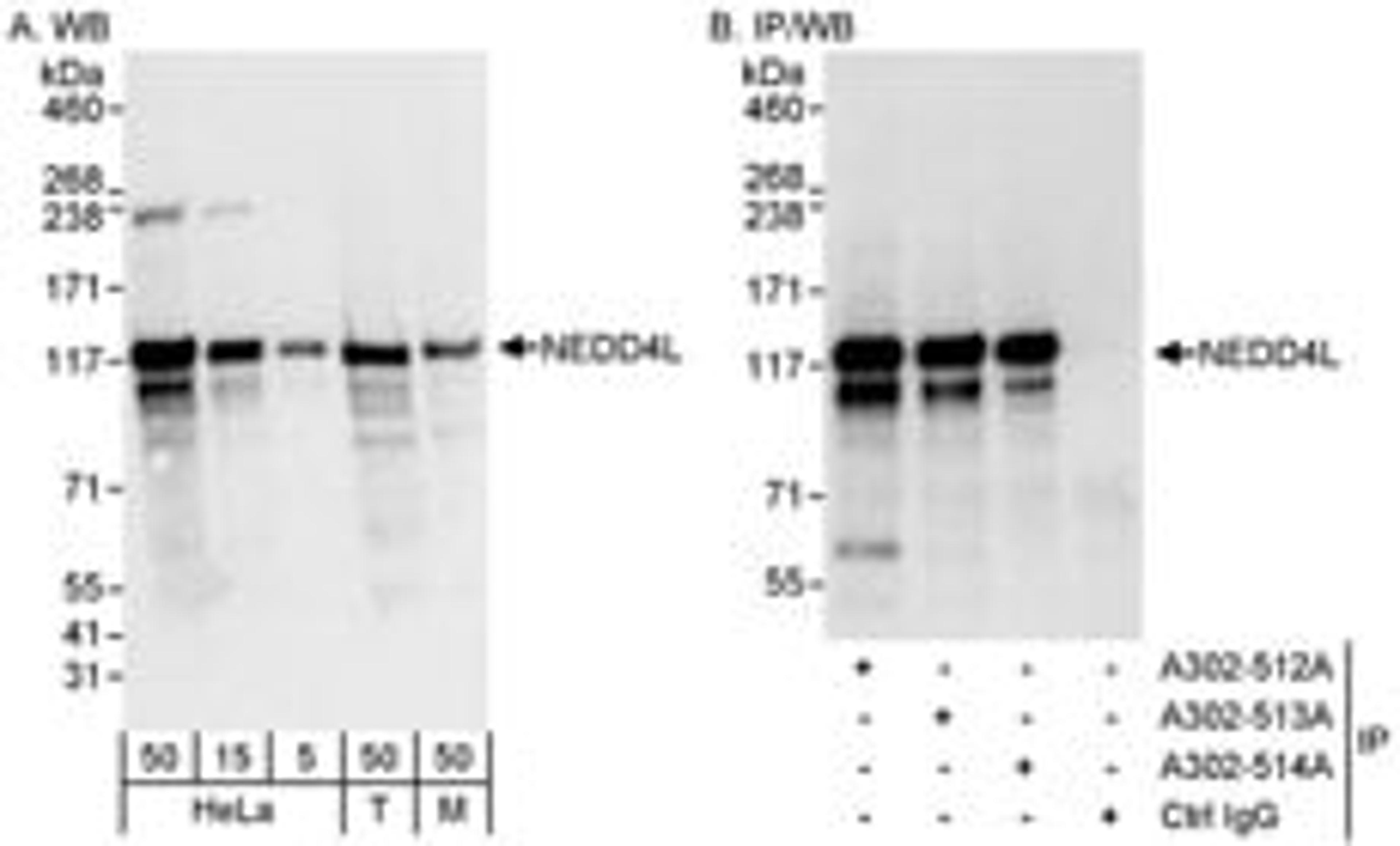 Detection of human and mouse NEDD4L by western blot (h&m) and immunoprecipitation (h).