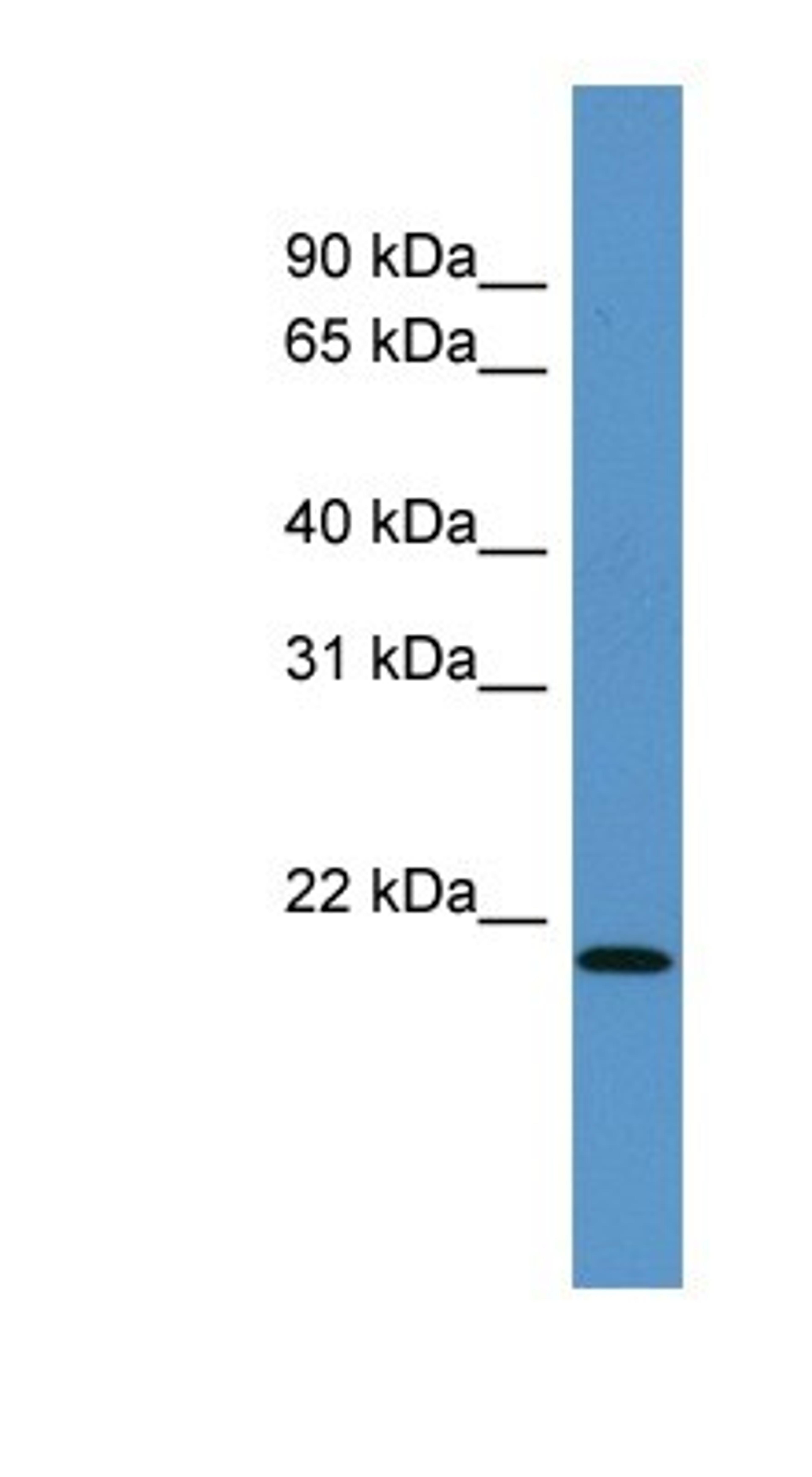 Western Blot: ARPC4 Antibody [NBP1-69003] - Mouse Intestine, concentration 0.2-1 ug/ml.