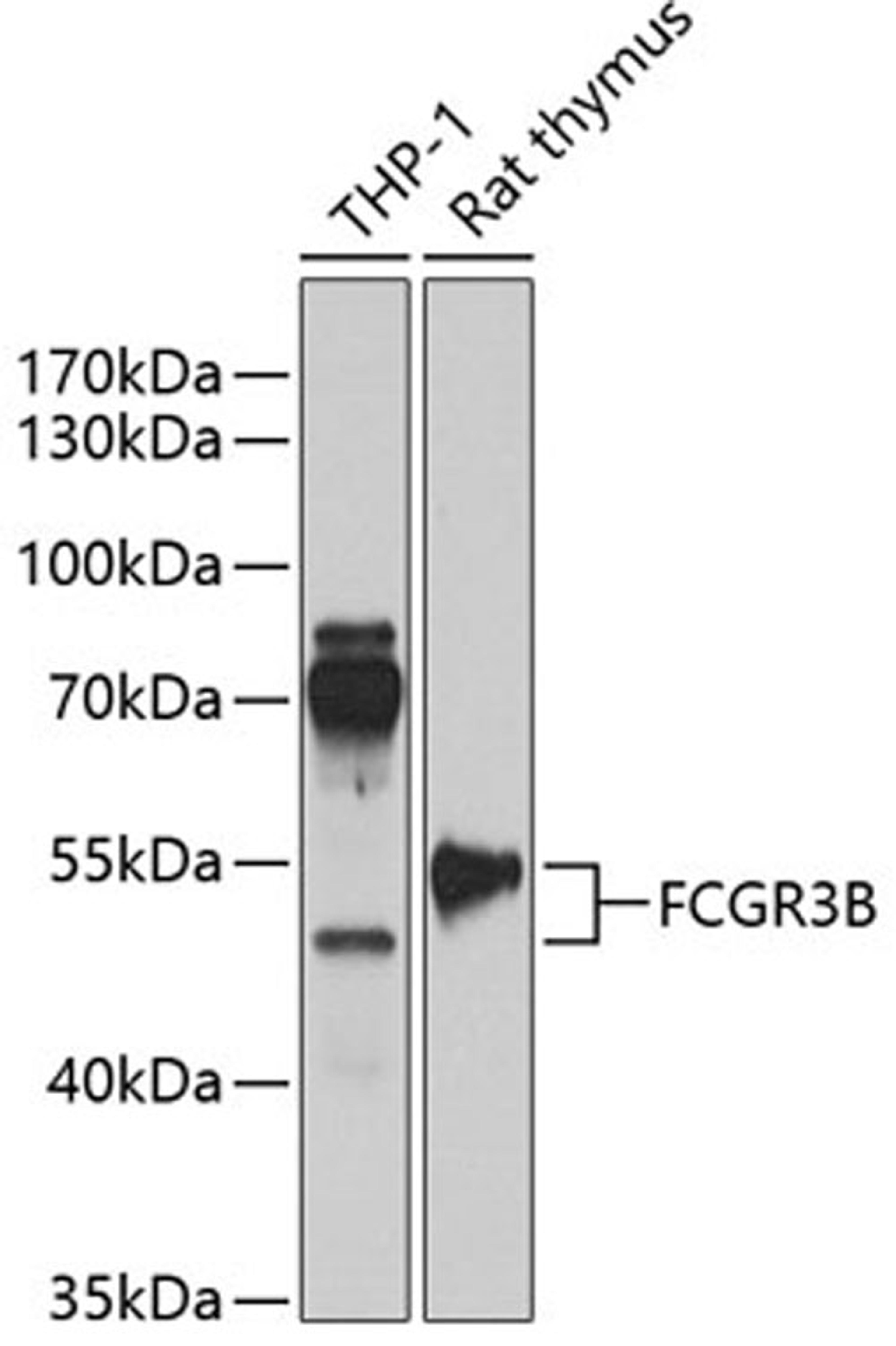 Western blot - FCGR3B antibody (A13980)