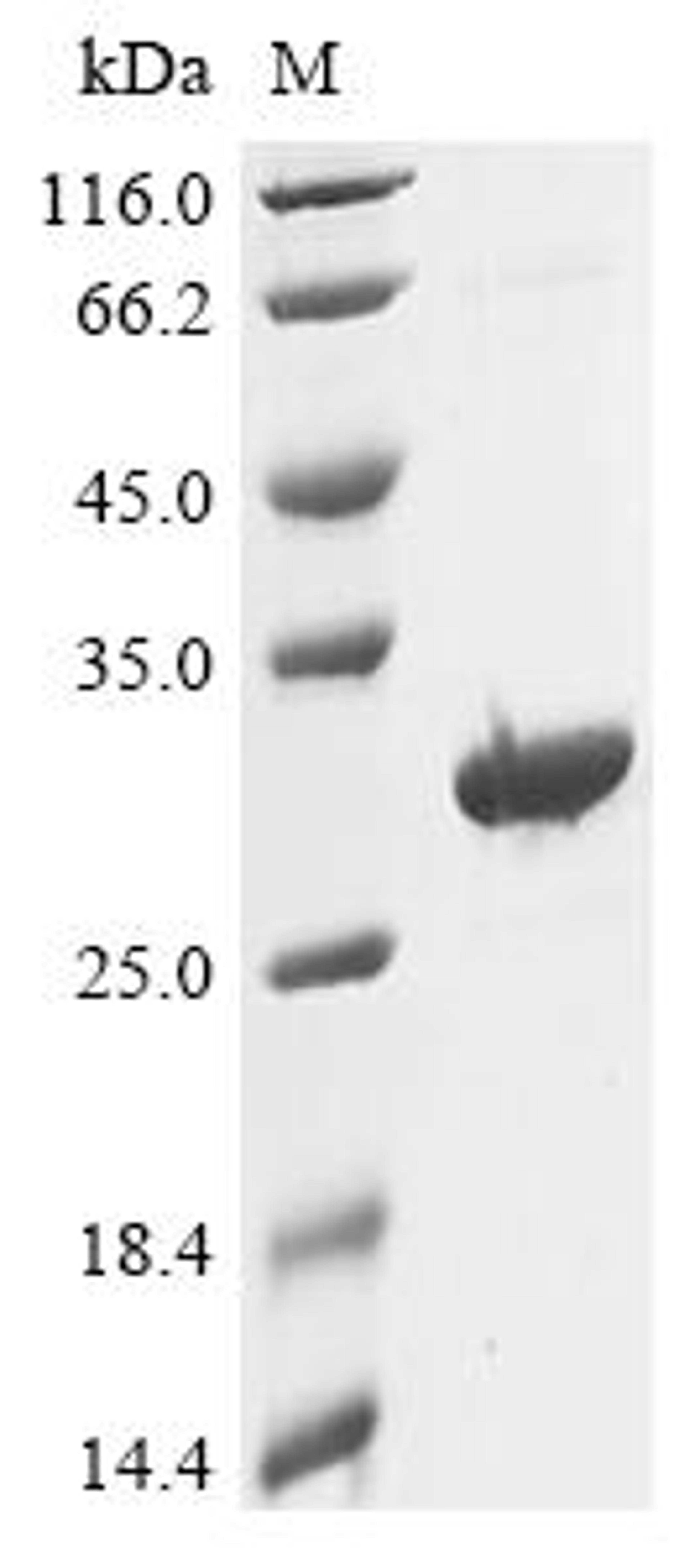 (Tris-Glycine gel) Discontinuous SDS-PAGE (reduced) with 5% enrichment gel and 15% separation gel.
