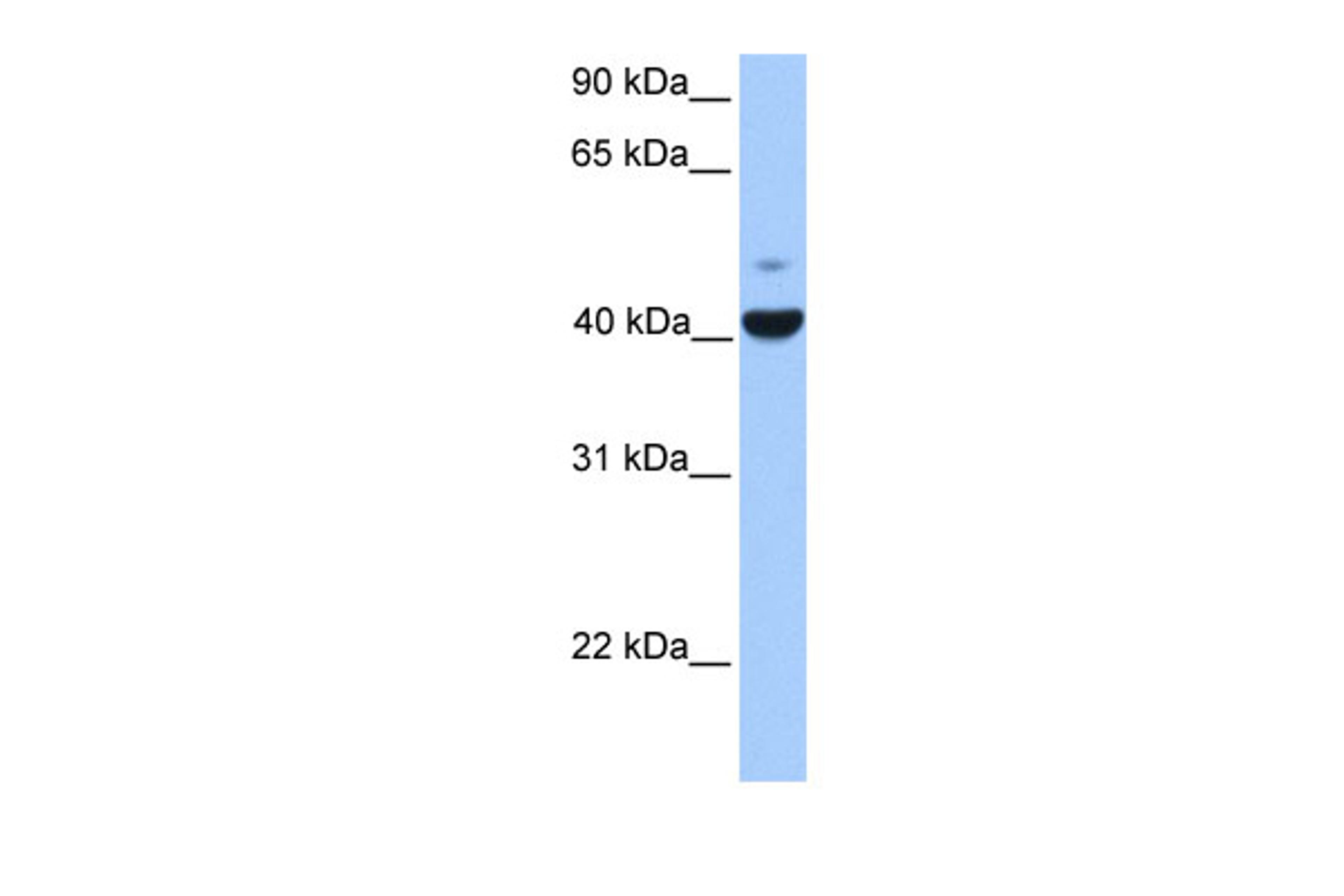 Antibody used in WB on Human Placenta at 0.2-1 ug/ml.