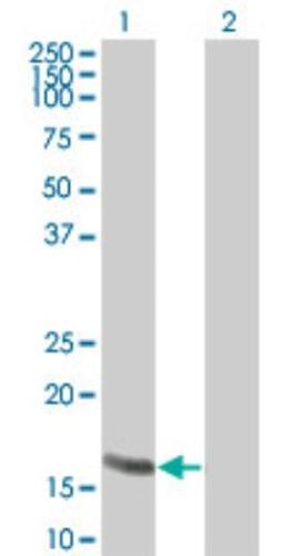 Western Blot: RGS13 Antibody [NBP2-24415] - analysis of RGS13 in 1) transfected 293T cells and 2) untransfected 293T cells using this antibody.