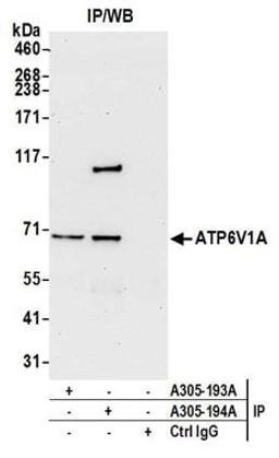 Detection of human ATP6V1A by western blot of immunoprecipitates.