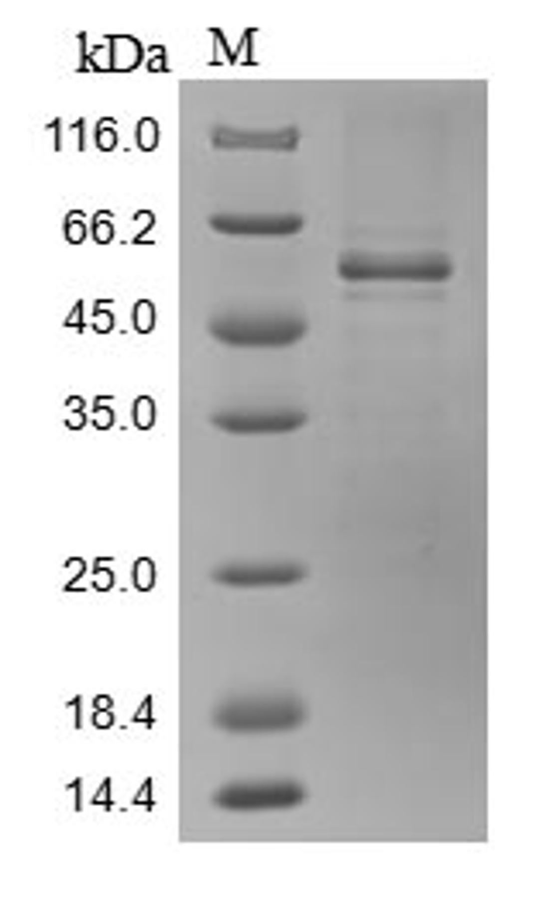 (Tris-Glycine gel) Discontinuous SDS-PAGE (reduced) with 5% enrichment gel and 15% separation gel.