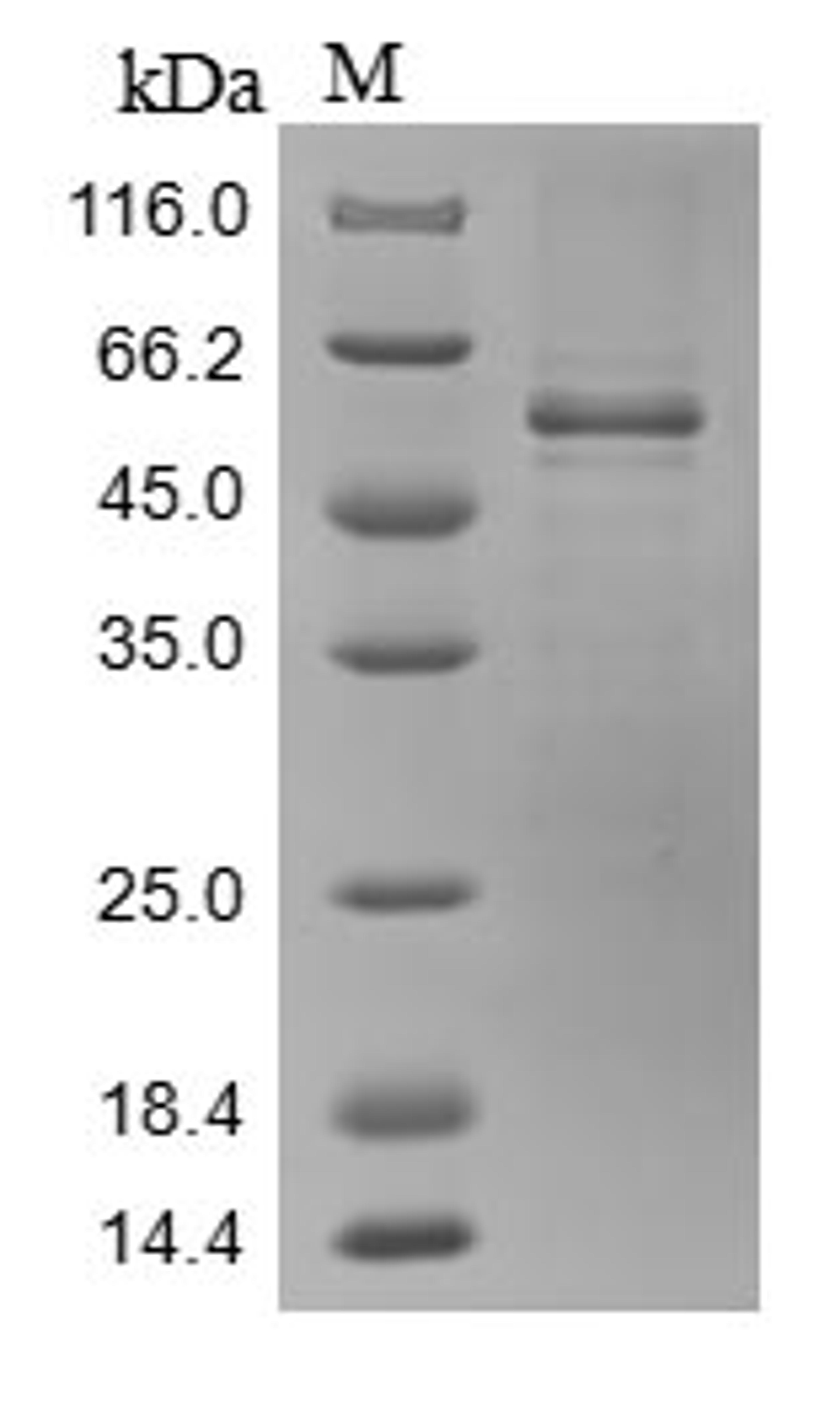 (Tris-Glycine gel) Discontinuous SDS-PAGE (reduced) with 5% enrichment gel and 15% separation gel.