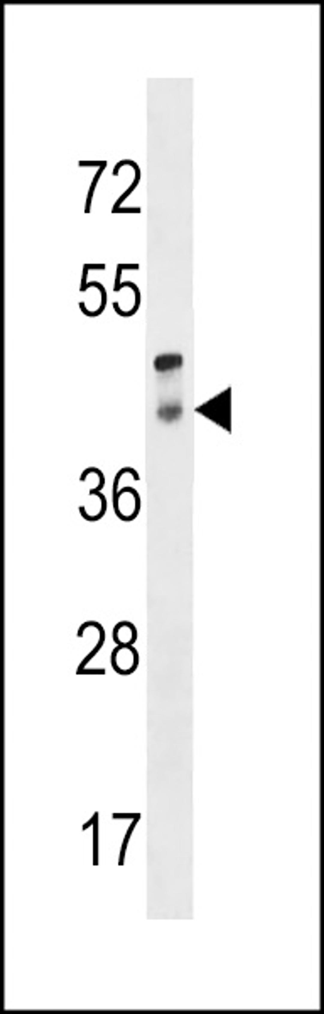 Western blot analysis in human placenta tissue lysates (35ug/lane).