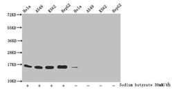 Western Blot. Detected samples: Hela whole cell lysate, A549 whole cell lysate, K562 whole cell lysate, HepG2 whole cell lysate; Untreated (-) or treated (+) with 30mM sodium butyrate for 4h. All lanes: HIST1H3A antibody at 1.1µg/ml. Secondary. Goat polyclonal to rabbit IgG at 1/50000 dilution. Predicted band size: 16 kDa. Observed band size: 16 kDa