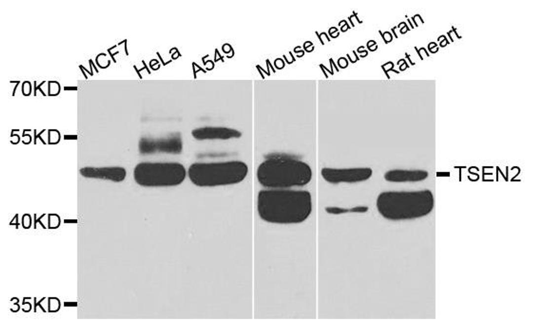 Western blot analysis of extracts of various cells using TSEN2 antibody