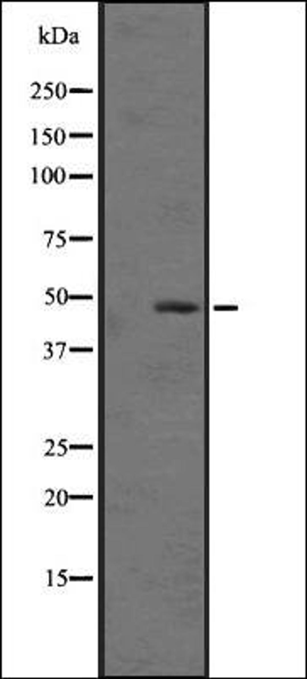 Western blot analysis of Hela cell lysate using C5ARL antibody