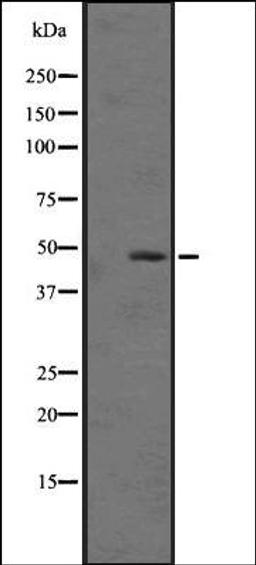 Western blot analysis of Hela cell lysate using C5ARL antibody