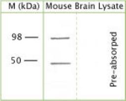 Western Blot: TRPV4 Antibody [NB110-74960] - Mouse brain lysate (reduced, denatured) using Rabbit antibody to 1t cytoplasmic loop of TRPV4: whole serum at 1:1000 dilution.