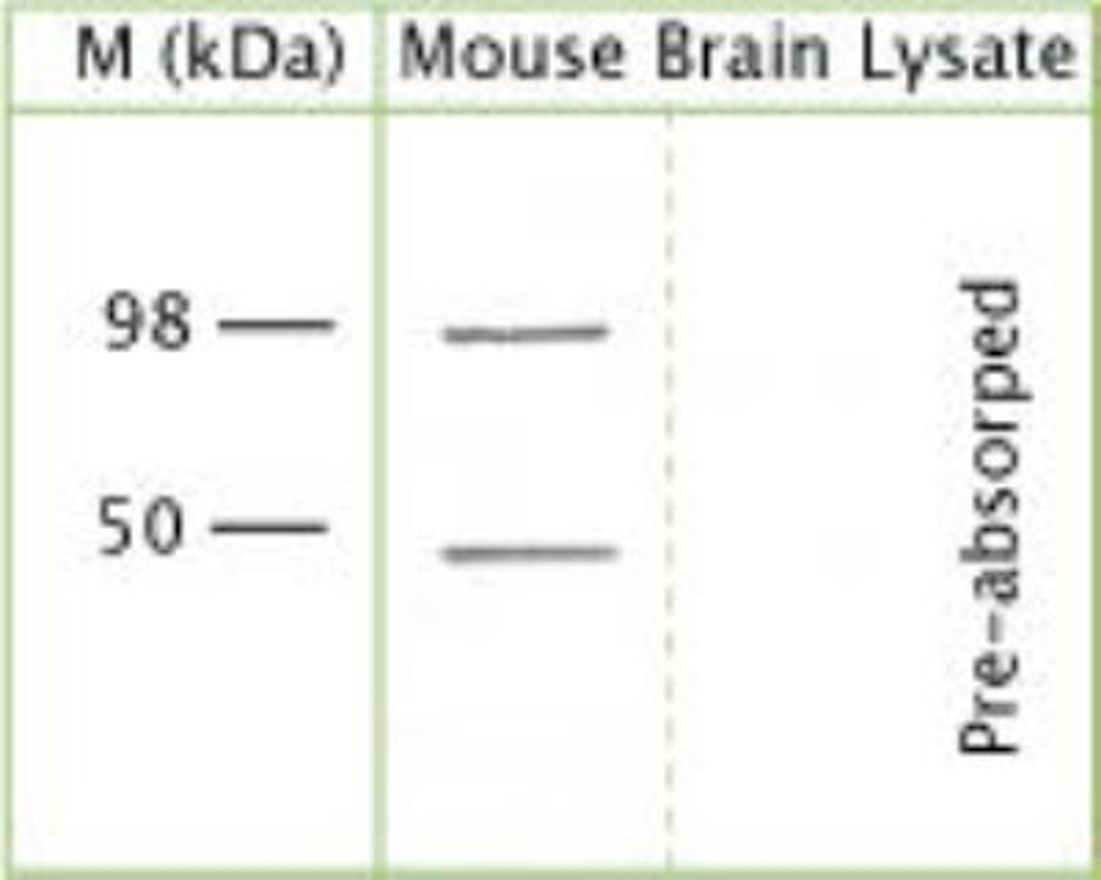 Western Blot: TRPV4 Antibody [NB110-74960] - Mouse brain lysate (reduced, denatured) using Rabbit antibody to 1t cytoplasmic loop of TRPV4: whole serum at 1:1000 dilution.