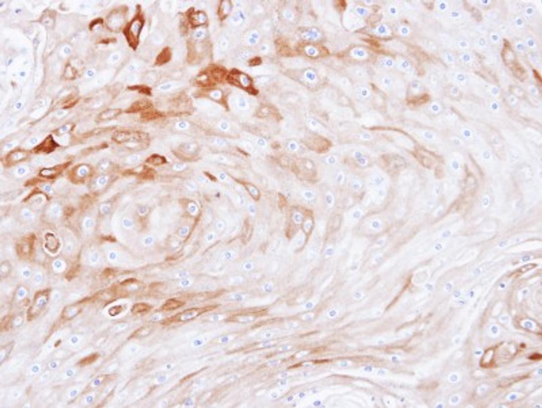 Immunohistochemistry-Paraffin: BCAT2 Antibody [NBP1-32652] - Paraffin-embedded Ca922 xenograft, using antibody at 1:100 dilution.