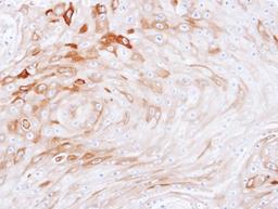 Immunohistochemistry-Paraffin: BCAT2 Antibody [NBP1-32652] - Paraffin-embedded Ca922 xenograft, using antibody at 1:100 dilution.