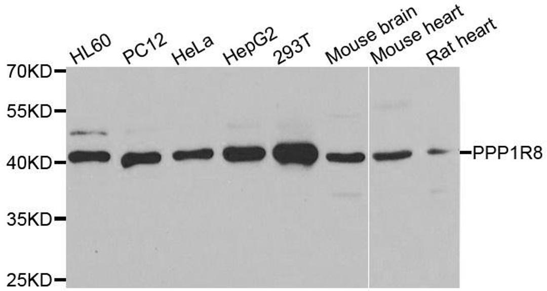 Western blot analysis of extracts of various cell lines using PPP1R8 antibody