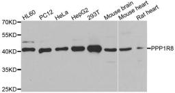 Western blot analysis of extracts of various cell lines using PPP1R8 antibody