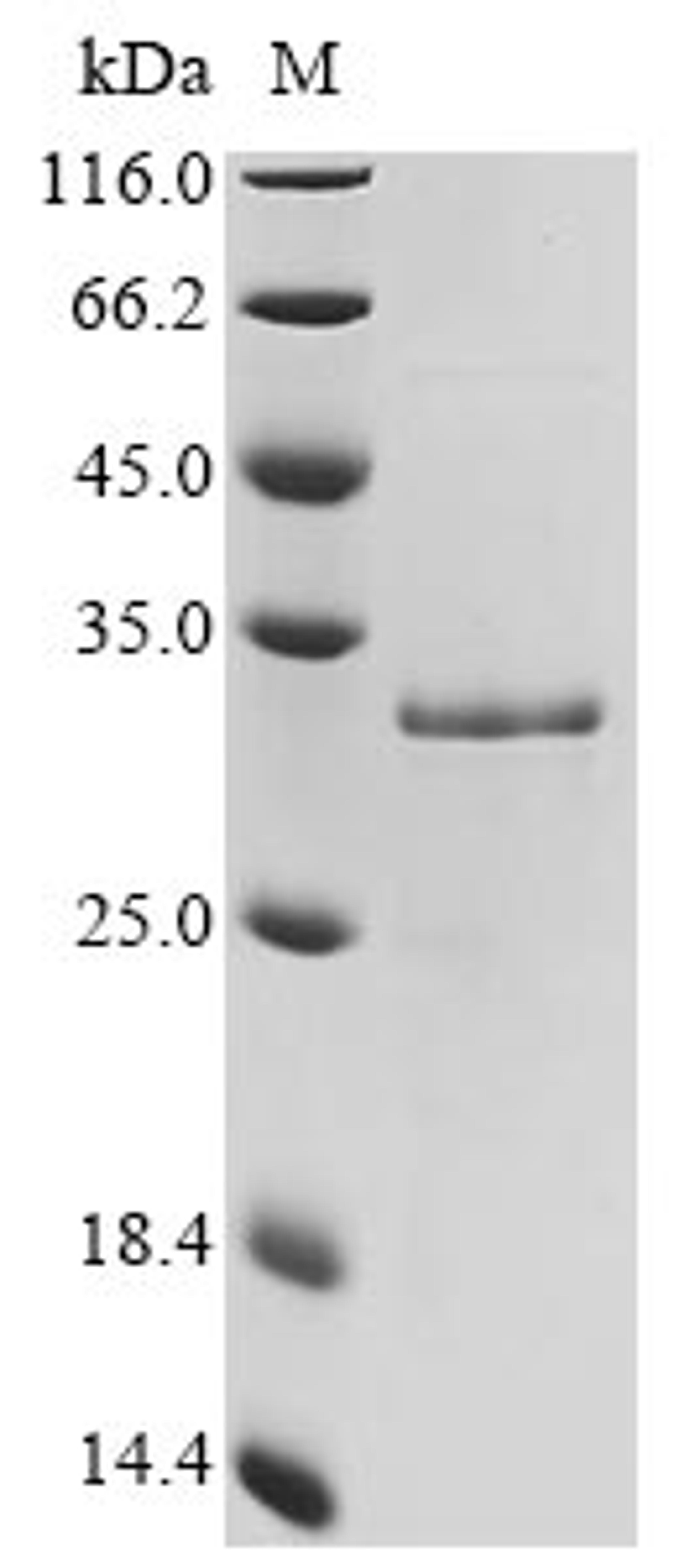 (Tris-Glycine gel) Discontinuous SDS-PAGE (reduced) with 5% enrichment gel and 15% separation gel.