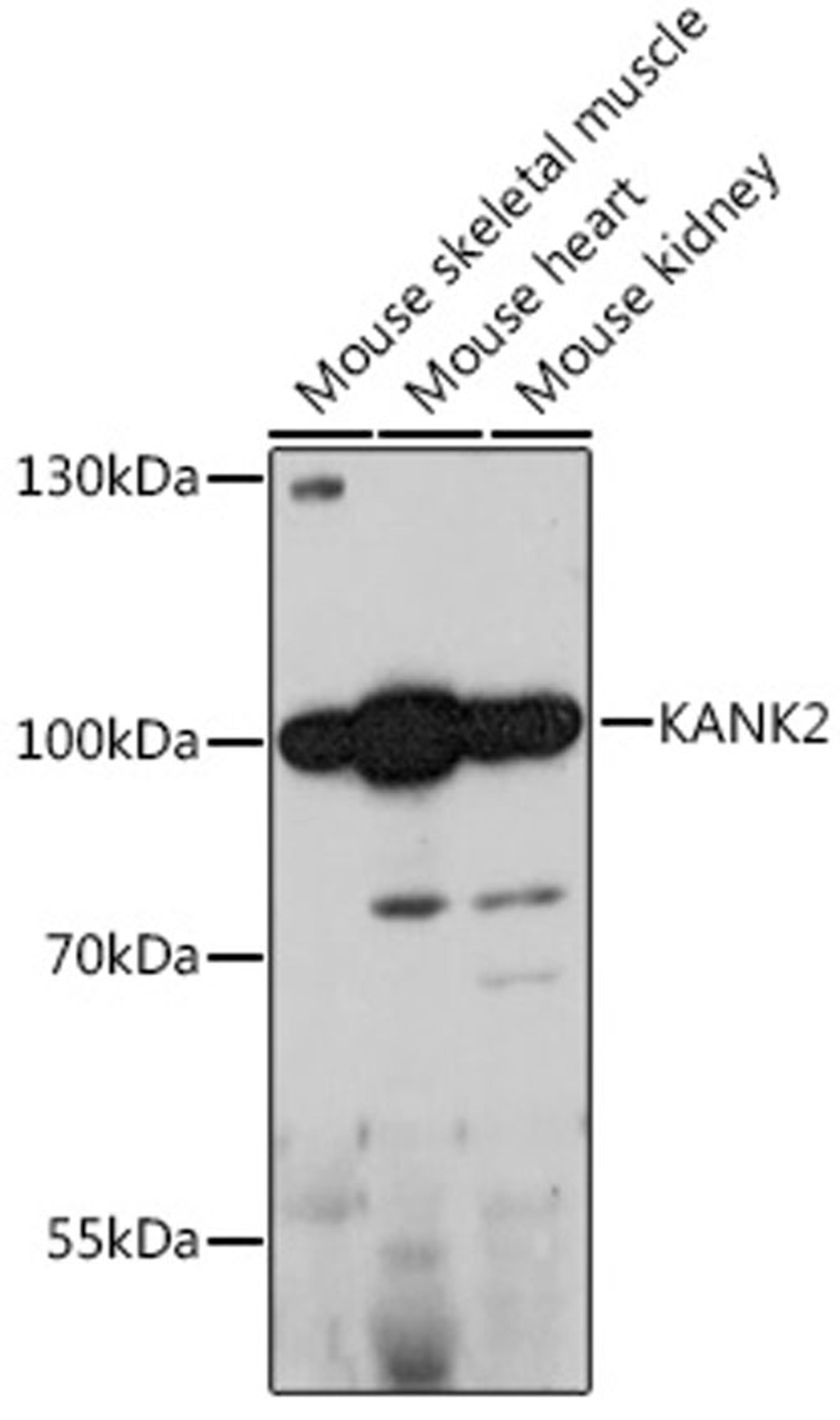 Western blot - KANK2 antibody (A15420)