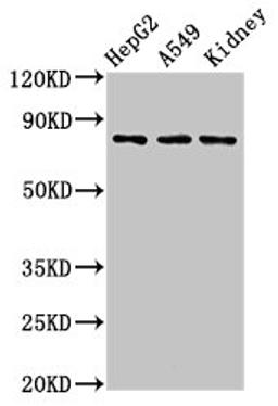 Western Blot. Positive WB detected in: HepG2 whole cell lysate, A549 whole cell lysate, Rat kidney tissue. All lanes: UIMC1 antibody at 3µg/ml. Secondary. Goat polyclonal to rabbit IgG at 1/50000 dilution. Predicted band size: 80, 62, 71, 39, 18 kDa. Observed band size: 80 kDa