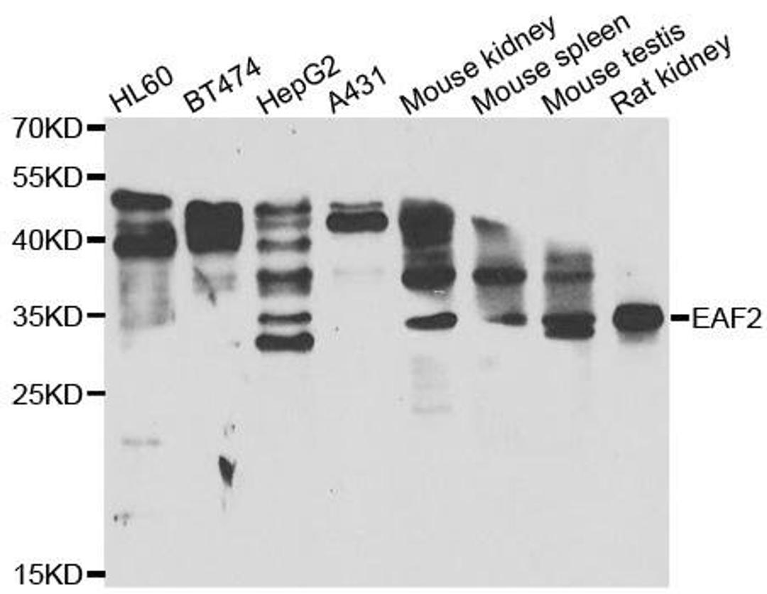 Western blot analysis of extracts of various cell lines using EAF2 antibody