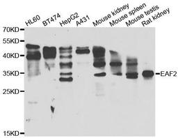 Western blot analysis of extracts of various cell lines using EAF2 antibody