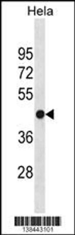 Western blot analysis in Hela cell line lysates (35ug/lane).This demonstrates the detected the FH protein (arrow).