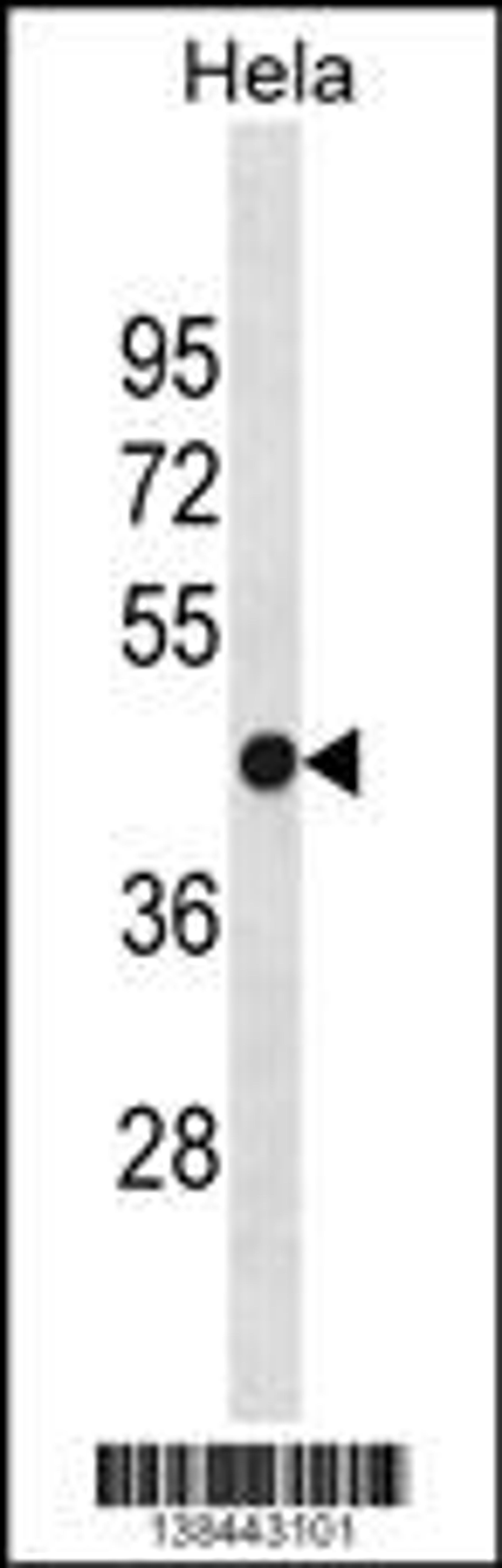 Western blot analysis in Hela cell line lysates (35ug/lane).This demonstrates the detected the FH protein (arrow).