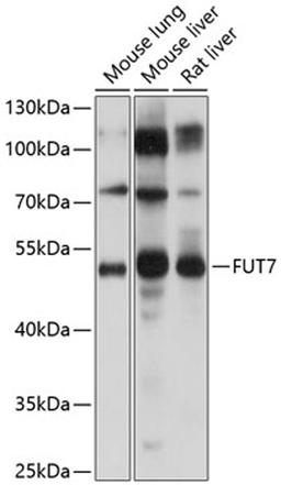 Western blot - FUT7 Antibody (A9338)