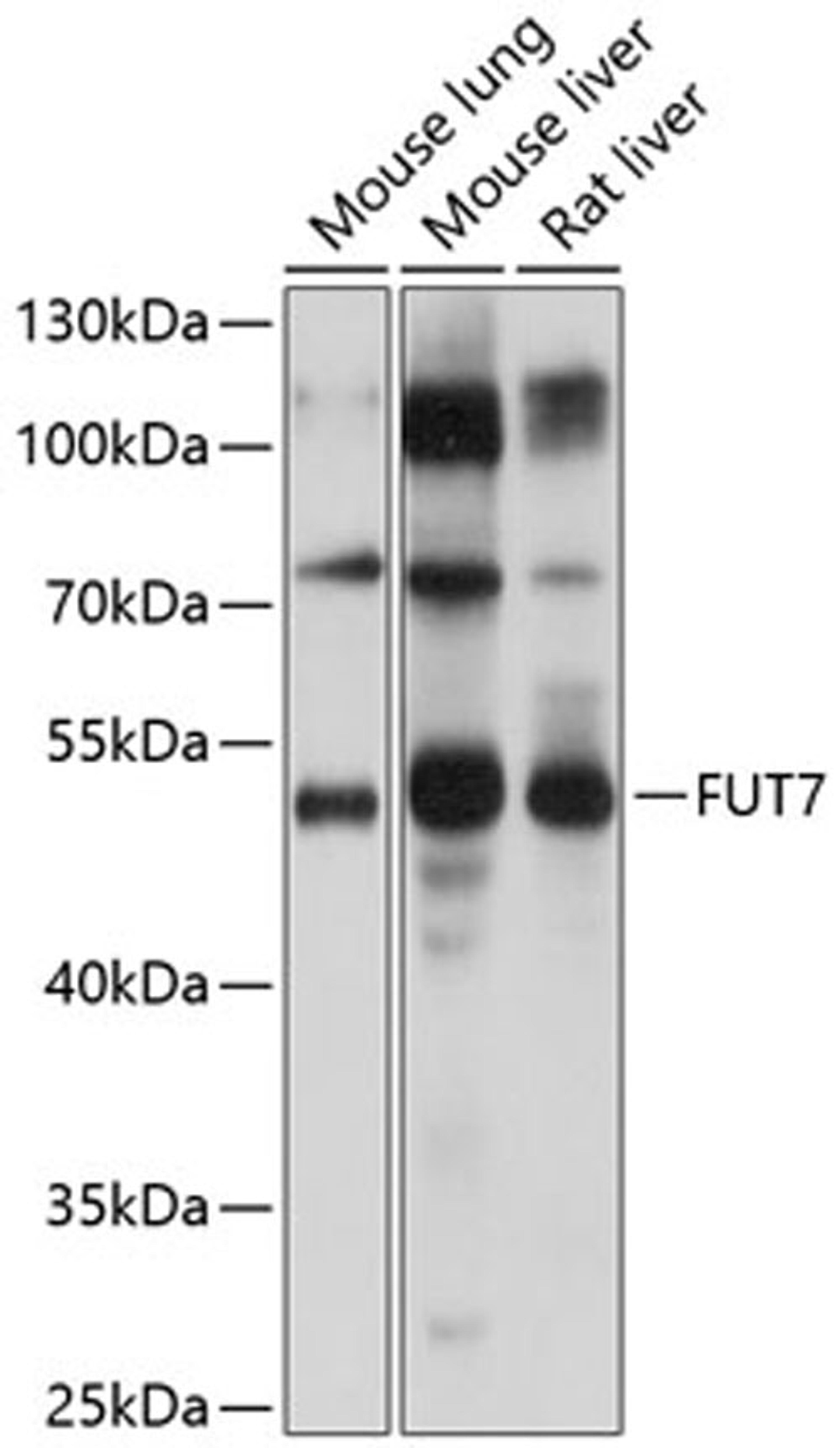 Western blot - FUT7 Antibody (A9338)