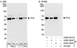 Detection of human and mouse TFG by western blot (h&m) and immunoprecipitation (h).