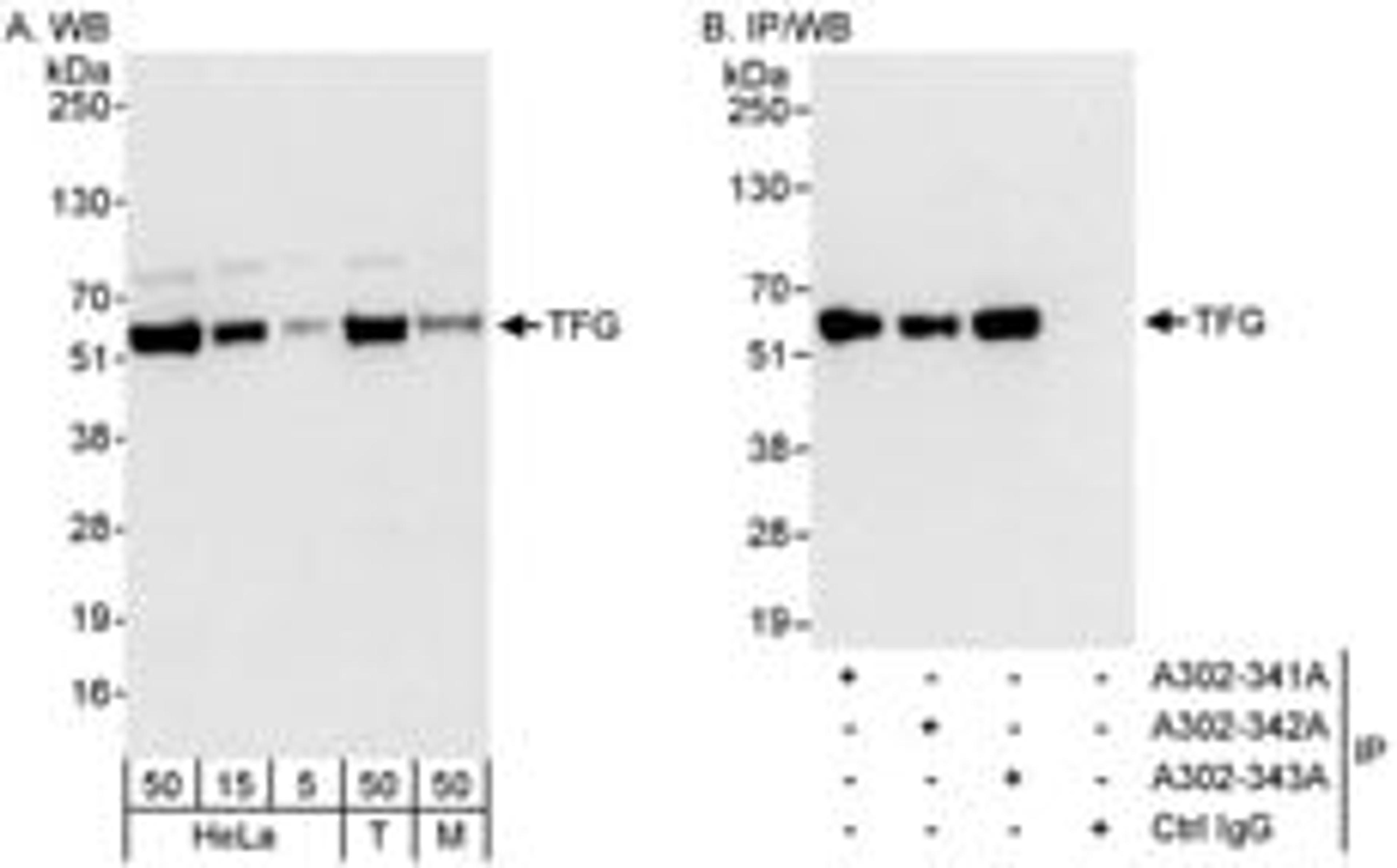 Detection of human and mouse TFG by western blot (h&m) and immunoprecipitation (h).