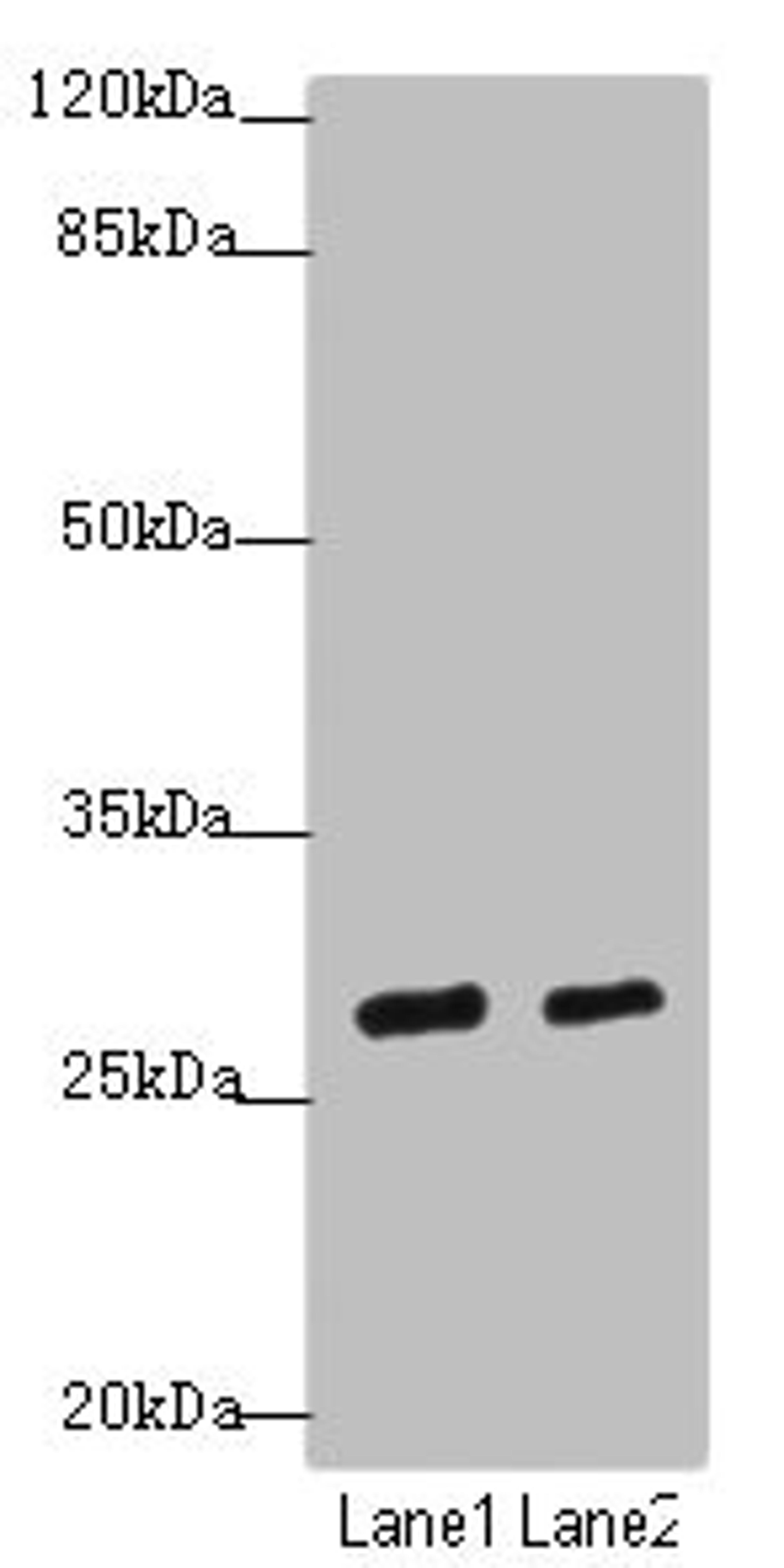 Western blot. All lanes: KLF9antibody at 4.43ug/ml. Lane 1: Mouse kidney tissue. Lane 2: Mouse liver tissue. Secondary. Goat polyclonal to rabbit IgG at 1/10000 dilution. Predicted band size: 27 kDa. Observed band size: 27 kDa. 