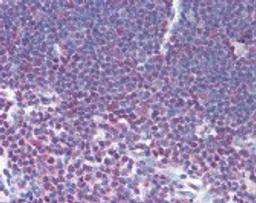 Immunohistochemistry staining of NFATC1 in thymus tissue using NFATC1 Antibody.