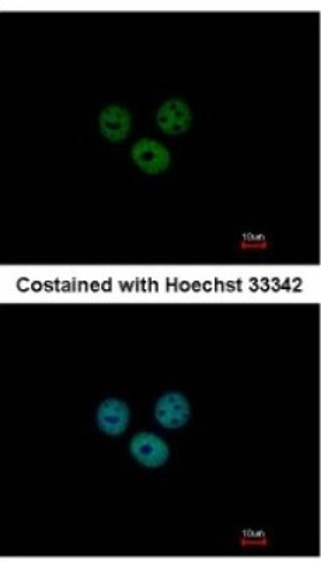 Immunocytochemistry/Immunofluorescence: RCBTB1 Antibody [NBP2-20116] - Analysis of paraformaldehyde-fixed MCF-7, using antibody at 1:200 dilution.