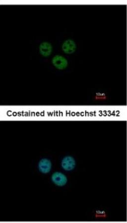 Immunocytochemistry/Immunofluorescence: RCBTB1 Antibody [NBP2-20116] - Analysis of paraformaldehyde-fixed MCF-7, using antibody at 1:200 dilution.