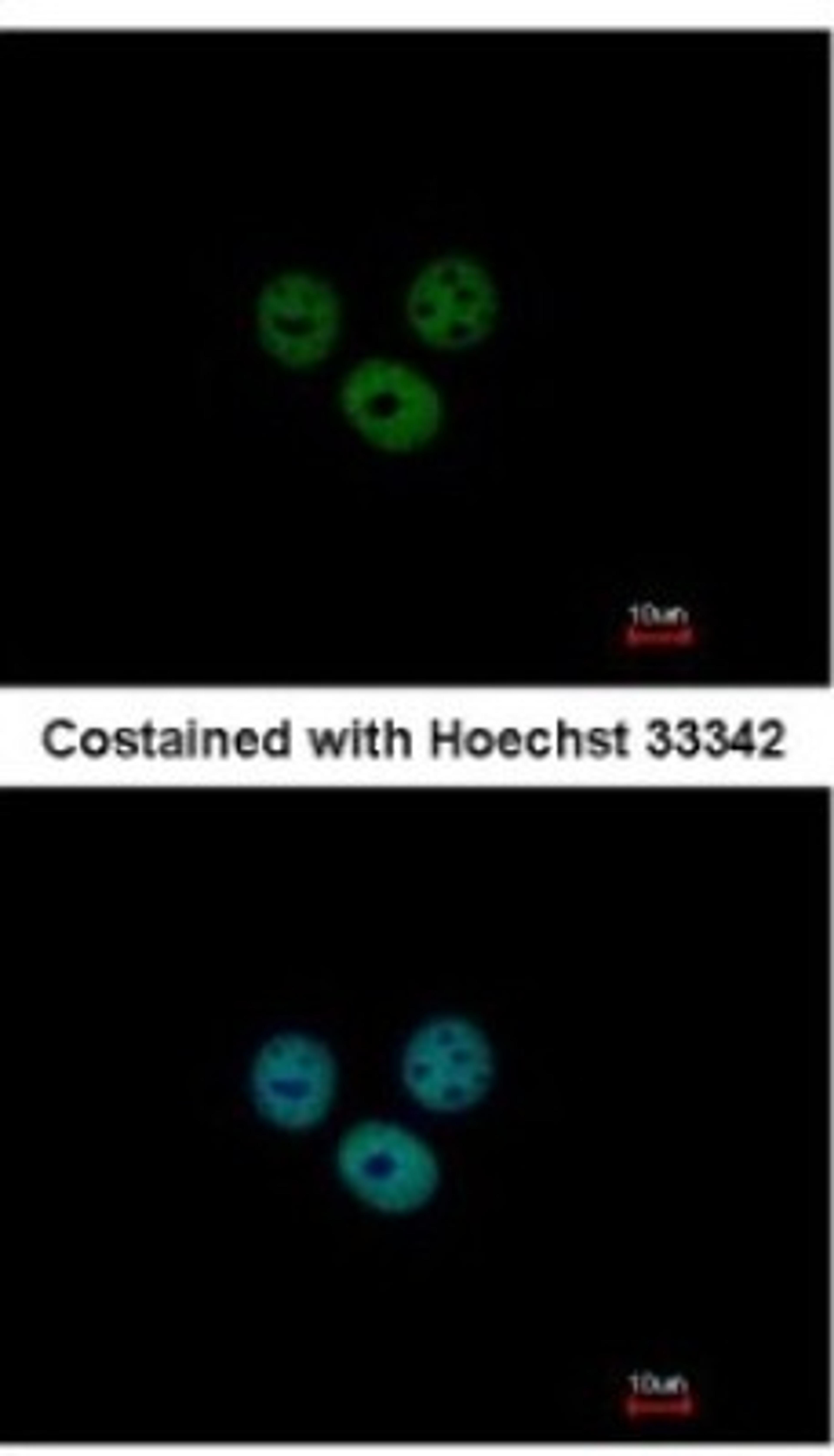 Immunocytochemistry/Immunofluorescence: RCBTB1 Antibody [NBP2-20116] - Analysis of paraformaldehyde-fixed MCF-7, using antibody at 1:200 dilution.