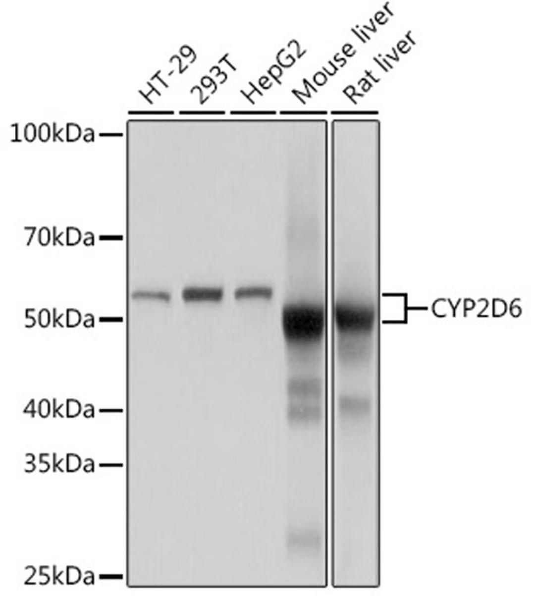 Western blot - CYP2D6 Rabbit mAb (A9562)