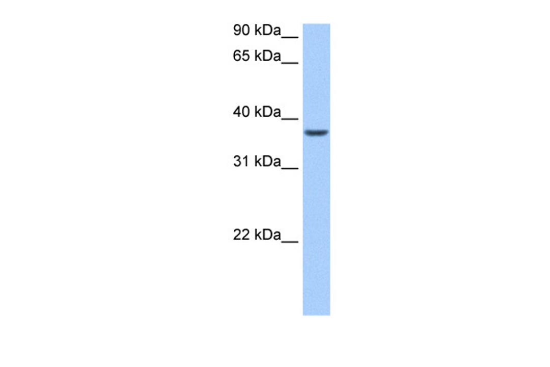 Antibody used in WB on Human Liver at 0.2-1 ug/ml.